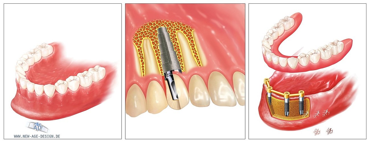 new-age-design-2D_Illustration_19